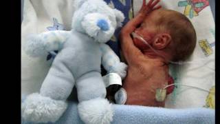 24 Week Preemie  Christiaan Brink Jou eerste jaar  Your first year [upl. by Neroled474]