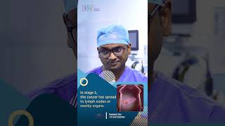 Liver Metastasis in Stage 4 Cancer Key Differences and What They Mean  Dr Praveen Kammar [upl. by Firooc]