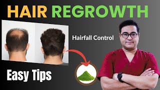 Guaranteed Hair Regrowth Tips by Dr Vikram  hairregrowth hairfall [upl. by Nol]