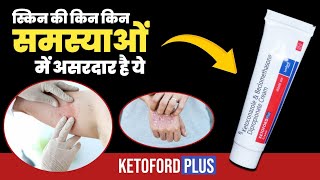 Ketoford Plus Cream Uses  Ketoconazole And Beclomethasone  Ketoconazole Cream For Fungal [upl. by Neeli]