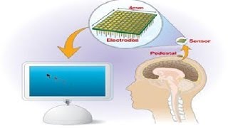 Seminar Report on Braingate [upl. by Ahtelrac]