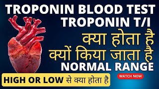 Troponin test in hindi  Troponin t test  troponin test normal range  troponin i test [upl. by Starbuck]