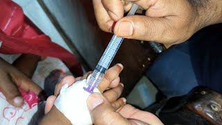 Child Meropenem 250mg amp Amikacin intravenous injection Video 24 Ep 71 Injection Tips [upl. by Nanaj]