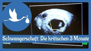 Eisprung  Fruchtbare Tage  Schwanger werden ✪ DSSKde [upl. by Oiligriv905]