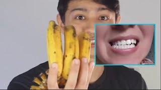 Testei se Casca de Banana Clareia os Dentes e o Resultado foi ESSE [upl. by Schecter594]