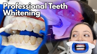 Teeth Whitening At The Dentist  Fastest Way To Whiten Your Teeth [upl. by Nairret]