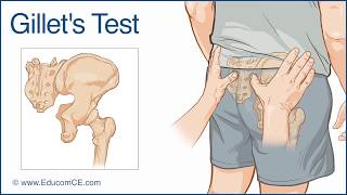 Gillets Test for Sacroiliac dysfunction  Chiropractic Online CE™ [upl. by Philippine]