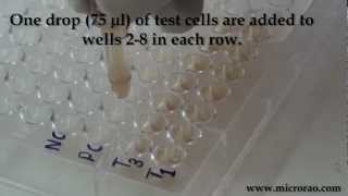 Treponema Pallidum Hemagglutination TPHA test for syphilis [upl. by Kendell]