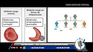 SANTÉ  LA DRÉPANOCYTOSE SS COMPRENDRE LA MALADIE [upl. by Adnalram996]