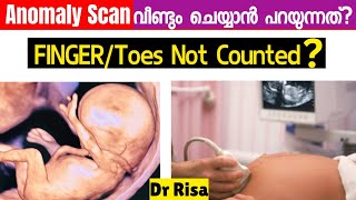 Anomaly Scan Malayalam  5th Month Pregnancy Scan [upl. by Maharva]