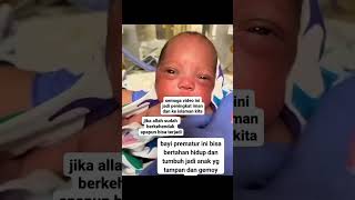 JIKA ALLAH SUDAH BERKEHENDAK APAPUN BISA TERJADI [upl. by Auqinahc]