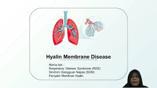 HYALIN MEMBRANE DISEASE HMD [upl. by Alliuqal263]