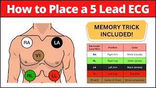 How to Place a 5 Lead ECG MNEMONIC Electrode Placement Made Easy nursing [upl. by Ialohcin]