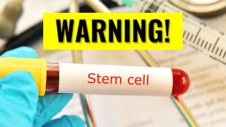 Stem Cell Therapy For Arthritis  The Truth You Need To Know [upl. by Rases718]