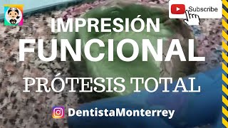 ⏩ Cómo Tomar Impresión Funcional 👅ProtesisDentales dentadura [upl. by Archaimbaud]