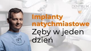 Implanty zębów implanty natychmiastowe zęby w jeden dzień [upl. by Babette869]