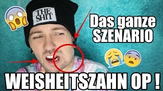 WEISHEITSZAHN OP  Das ganze SZENARIO TAGEBUCH  😰😪 [upl. by Zanlog]