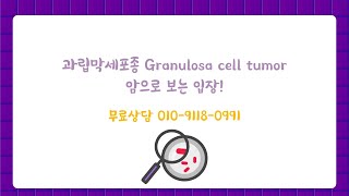 과립막세포종 Granulosa cell tumor 암으로 보는 입장 [upl. by Eudocia931]