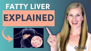 Fatty Liver Disease amp Diet Explained [upl. by Erdman]