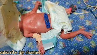 premature baby care in the nicu ward [upl. by Adoc313]