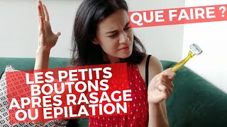 Ne plus avoir les boutons rouges après rasage ou épilation [upl. by Nahc156]