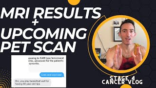 Stage 4 Cancer Vlog MRI Results amp PET Scan [upl. by Zerimar]