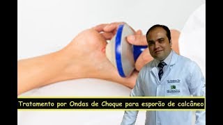 Tratamento por Ondas de Choque para esporão de calcâneo [upl. by Kir95]