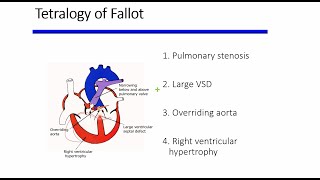 Cyanotic congenital heart diseases [upl. by Eikcor123]