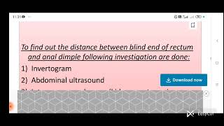 by diksha sharma Topic diagnostic evaluation of anorectal malformation [upl. by Ahsiken51]