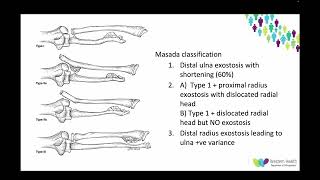 OrthoFracs  Osteochondroma and MHE by Dr Andrei Diacon [upl. by Parker337]