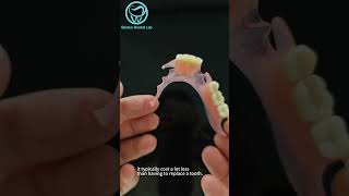 valplast partial denture dentallab valplast partialdenture [upl. by Angelina826]