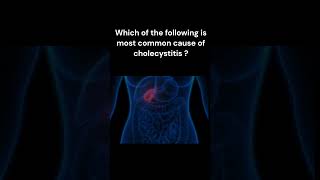 Quick quiz 63pathologylectures pathology [upl. by Areehs912]