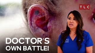 A Dermatologist’s Personal Fight  Dr Pimple Popper TLC [upl. by Lusty]