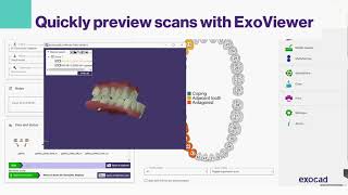 MyiTero for labs integration with exocad DentalCAD 30 Galway [upl. by Gibbons411]