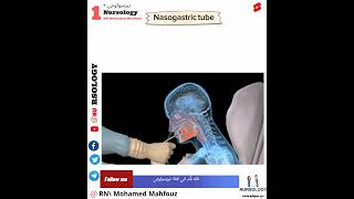 NasogastricTubeكيفية تركيب أنبوب المعده [upl. by Anina442]