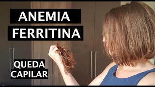 Ferritina Baixa  Anemia  Queda de cabelo  Parte 2 [upl. by Ettellocin424]