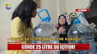 Günde 25 litre su içiyor [upl. by Manoff480]