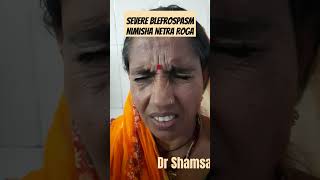 A Case of Blepharospasm Nimisha Netra Roga niajaipur dr Shamsa fiaz [upl. by Neile241]