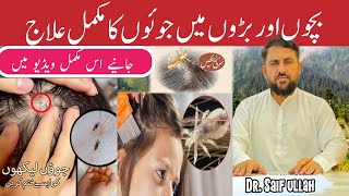 Sar Ki Juen Khatam Karne Ka Tarika  Head Lice Removal  Lice In Hair Symptoms Causes And Treatment [upl. by Rafaelof]