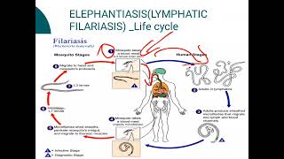 ElephantiasisLYMPHATIC FILARIASIS [upl. by Nylirehc]