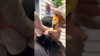 How to get rid of industrial piercing bumps using Base Laboratories Piercing Bump Treatment Oil [upl. by Ladin]