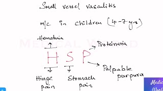 IgA Vasculitis  Henoch Schonlein Purpura Mnemonic [upl. by Raclima]