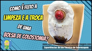 Como é feita a limpeza e a troca de um Bolsa de Colostomia [upl. by Ellenod]