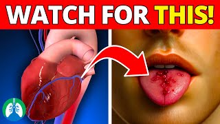 Taste Blood When Coughing  Causes and Treatment [upl. by Roxi]