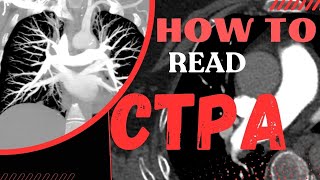 How to read CT pulmonary angiogram CTPA [upl. by Sucramd]