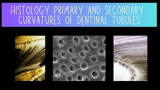 Histology of Primary and Secondary Dentinal Tubule Curvatures  Dentistry [upl. by Pascia]