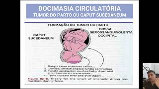 SEXOLOGIA FORENSE  parte 22  DOCIMASIA CIRCULATÓRIA  TUMOR DO PARTO [upl. by Einafets]