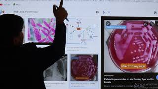 Klebsiella Pneumoniae USMLE Step 1 2021 Microbiology lecture 27 page145 [upl. by Ashli]