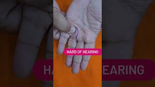 Acupressure Points for Tinnitus  Hard of Hearing tinnitus acupressure acupressurepoints [upl. by Warthman]