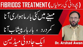 Fibroids CausesSymptoms And Treatment In Urdu [upl. by Suivatnom]